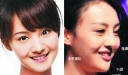 明星整形吃瓜爆料视频,吃瓜视频揭露整形内幕